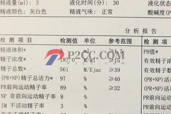 男性正常精子顏色對照表