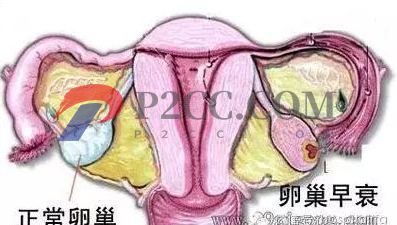女人做了試管嬰兒人就廢了？好可怕，真的嗎？(圖2)