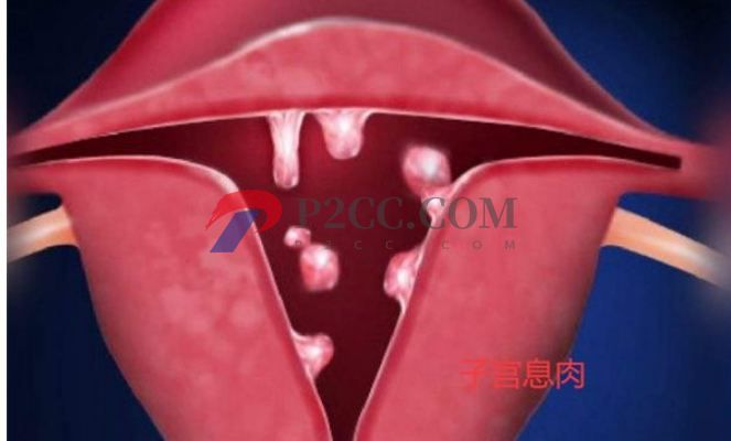 排卵期性腹痛和出血是怎么回事，需不需要治療？(圖2)