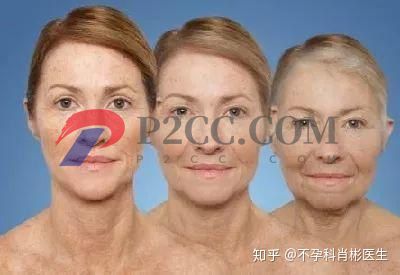 40歲絕經(jīng)和55歲絕經(jīng)有什么區(qū)別?(圖2)