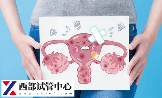 子宮內(nèi)膜異位癥是一種婦科疾病
