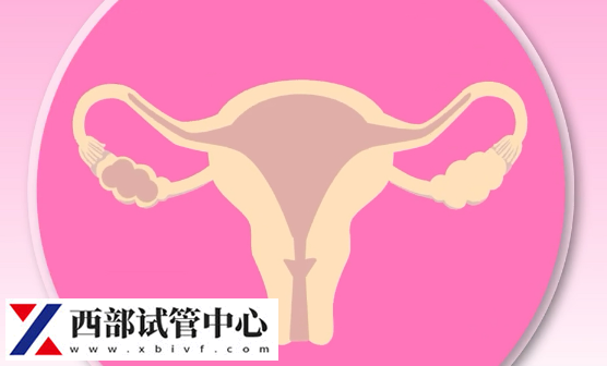 1期子宮內(nèi)膜異位癥患者通常無明顯癥狀