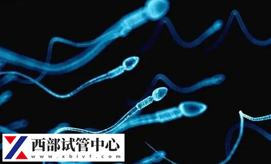形態(tài)好精子具有較低碎片率