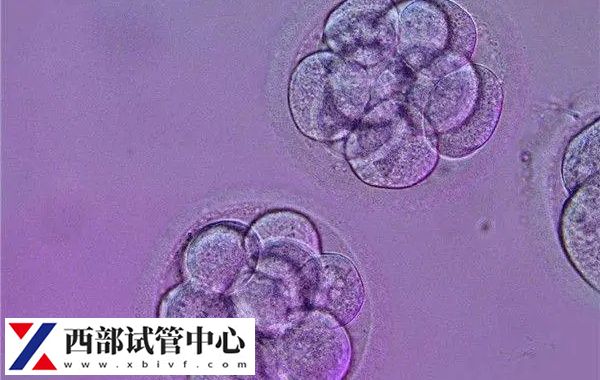 囊胚等級(jí)至少要達(dá)到4bc以上保證成功率