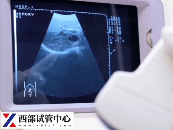 云南省做試管哪里技術好
