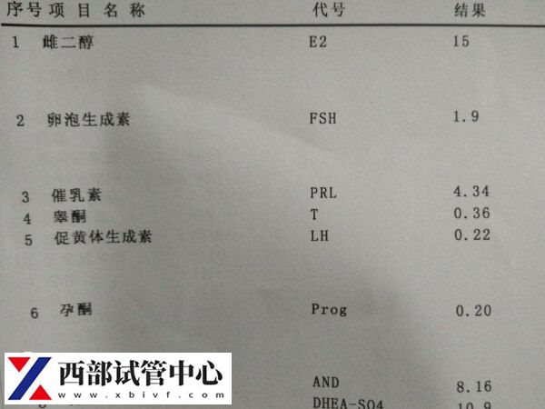 女人雌性激素過高會怎么樣