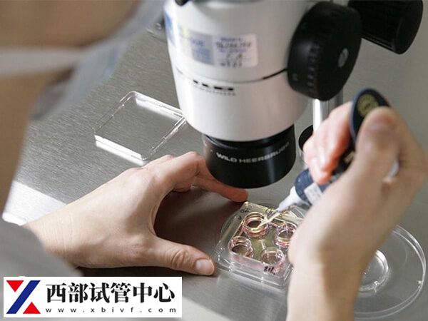 試管對(duì)amh值沒有要求
