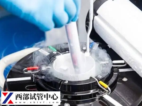 卵源配對(duì)是做供卵試管的流程之一