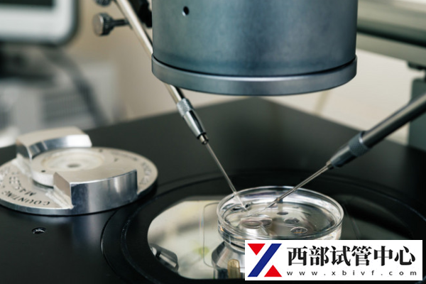 種植窗期間需要注意什么
