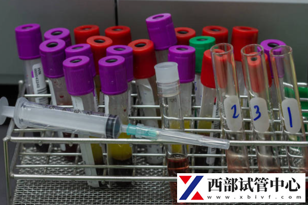 試管嬰兒費用如何節(jié)省