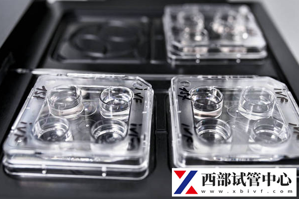 試管嬰兒和自然懷孕的區(qū)別是什么