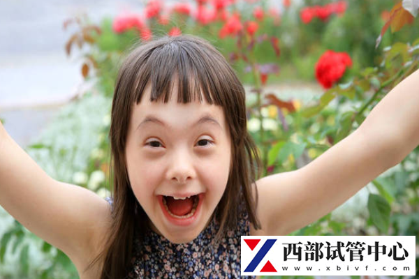 唐氏綜合癥指的是什么
