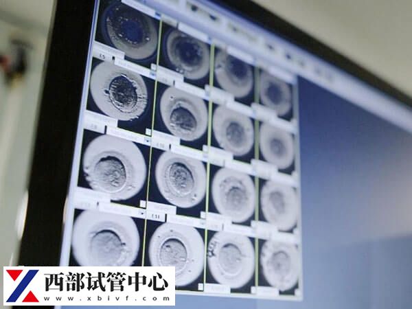 試管嬰兒成功后檢查流程步驟