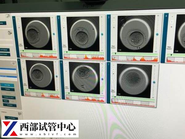 5天囊胚移植1到2天可能著床了