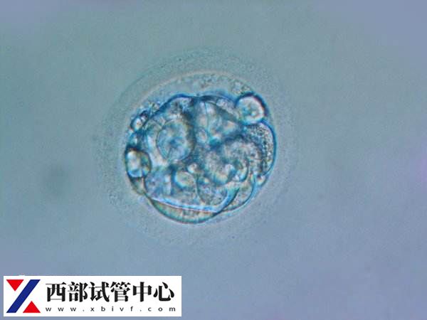 試管移植后會出現(xiàn)一些癥狀表現(xiàn)