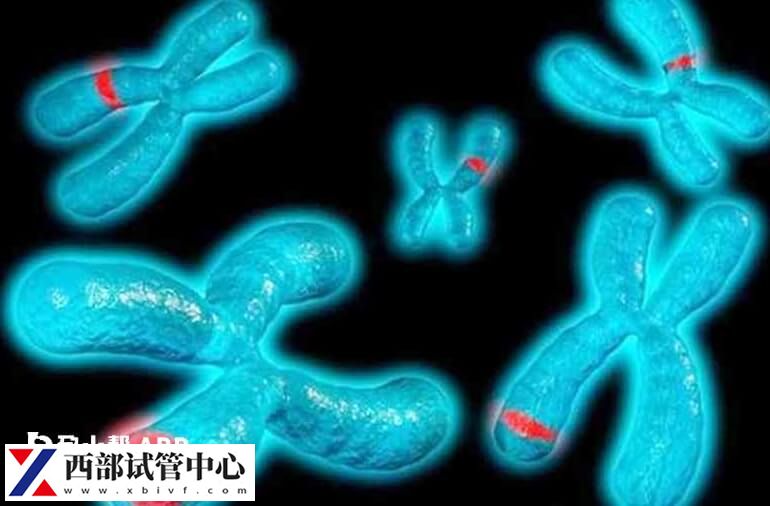 父母染色體易位是容易遺傳給兒子還是遺傳給女兒？
